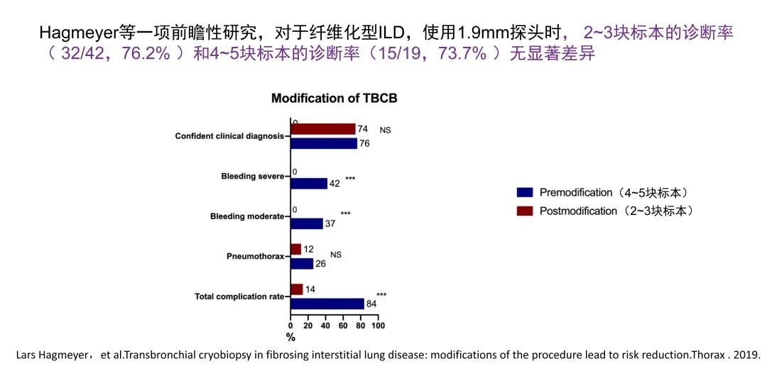 经皮肺穿刺活检术过程,经支气管冷冻肺活检