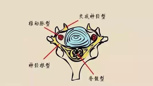 胸口后背疼痛八种病因,后背疼痛睡不着觉是什么病因