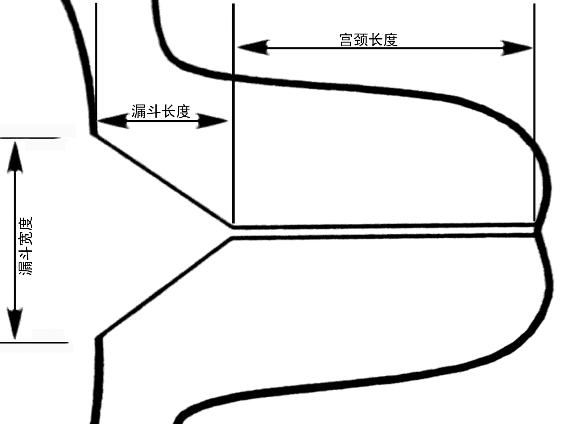30周早产儿的脑部超声,早产儿超声检查