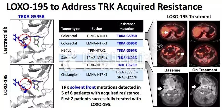 美国新上市的抗癌广谱药物,larotrectinib的靶向药