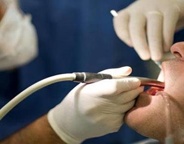 情人节不想开口牙黄很丢人？这招能让你牙白有气质！