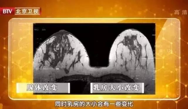 腋下有肉咋办但不是副乳,腋下有多余的赘肉怎么办图解