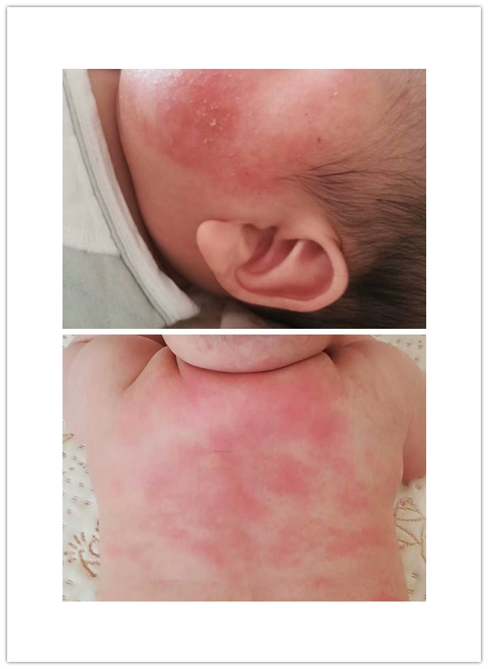 13个月湿疹宝宝使用过的婴儿面霜大盘点