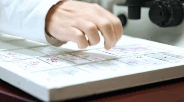 病理报告为什么这么慢,手术后病理报告准确率高吗