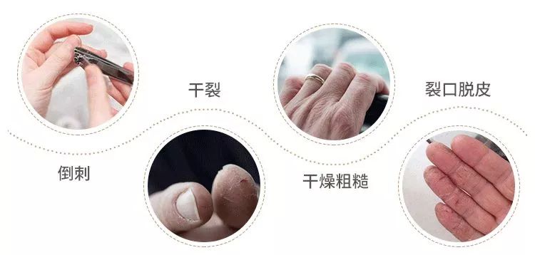 秋冬手干裂擦手霜,冬天手脚干裂涂什么护肤品