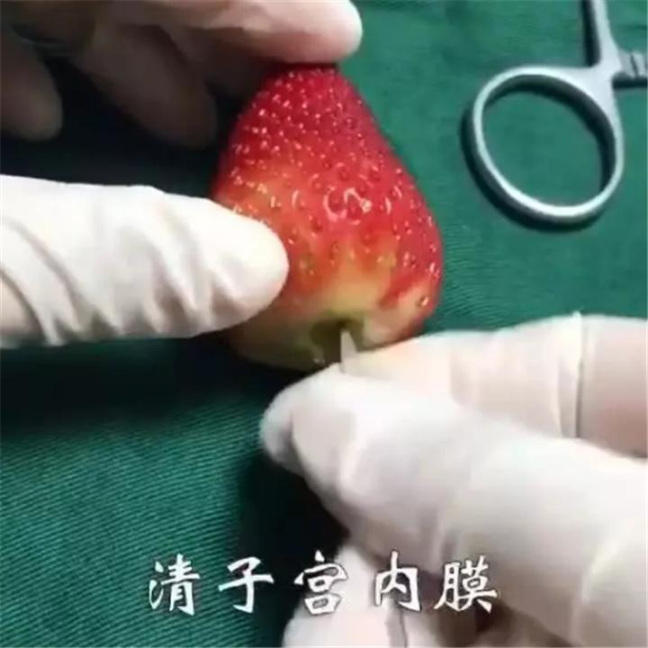 人流对女人伤害多大,人流对女性造成的伤害多久才会好