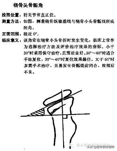 肘关节x线测量,肘关节骨骺示意图