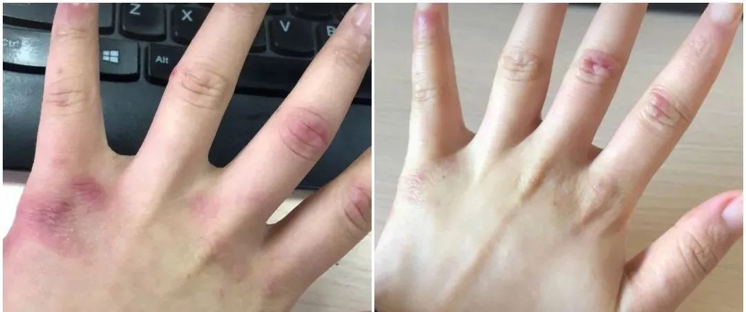 海豹油皮肤,海豹油外用美白效果怎么样