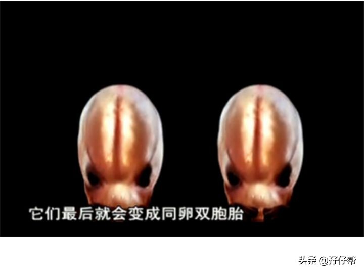 试管双胞胎是不是都是双绒双羊,双绒双羊双胞胎相差5天正常吗