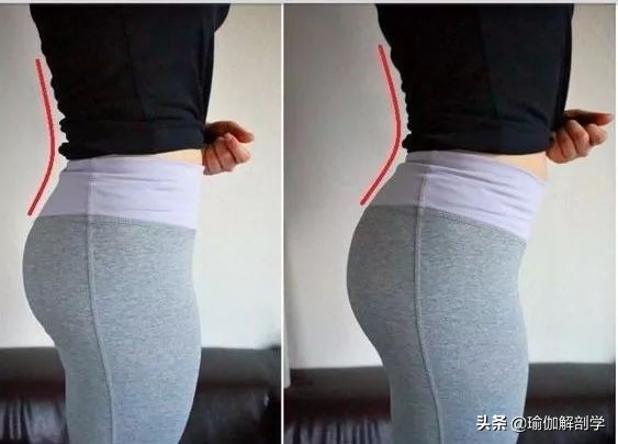 练瑜伽可以矫正骨盆前倾,练瑜伽时骨盆如何转动