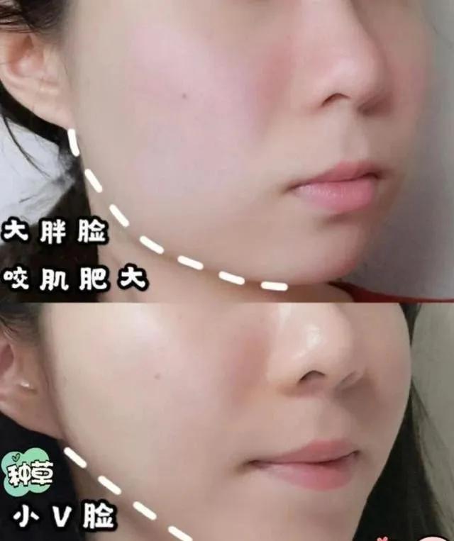 不整容真的能瘦脸吗,瘦脸面膜真的有用吗