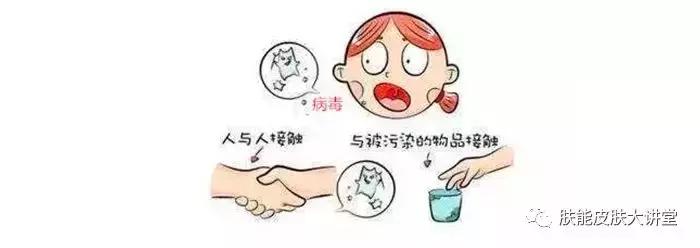 传染性水瘊子图片,水瘊子和传染性软疣一样吗