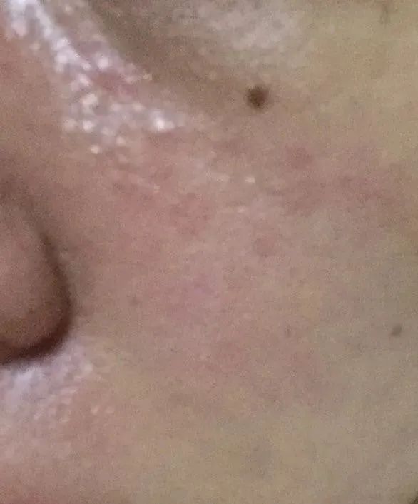 用大牌化妆品真的不会老吗,用大牌护肤品皮肤还是不好