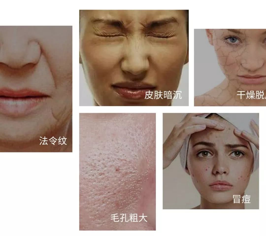 脸敏感泛红干燥紧绷用哪些护肤品,三伏天怎么护肤才能减少敏感