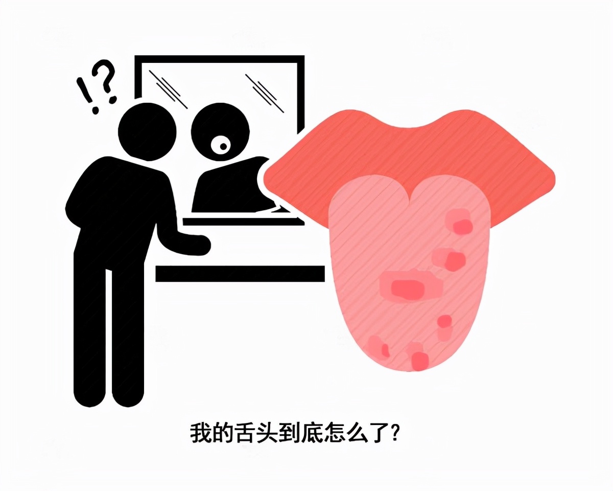 口腔溃疡长时间不好一定是舌癌吗,几乎每天都有口腔溃疡是舌癌吗