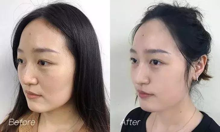 李湘国货精华液,李湘推荐的护肤品精华