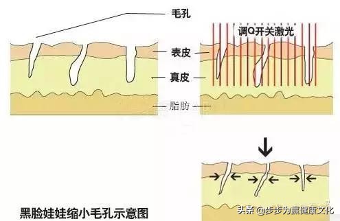 白瓷娃娃和黑脸娃娃,黑瓷娃娃和白娃娃有什么区别
