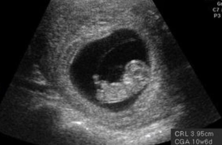 10周、20周、30周,胎儿分别是什么状态,看完满是感动,期待出生