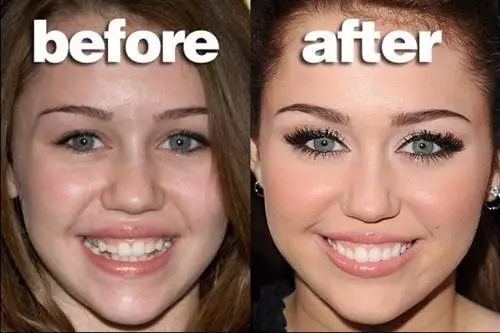 牙齿变黑变黄用什么清洗,牙齿发黄有牙垢用什么牙膏