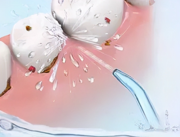 大连齿医生口腔科普牙齿松动怎么办?绝不能放任不管哦