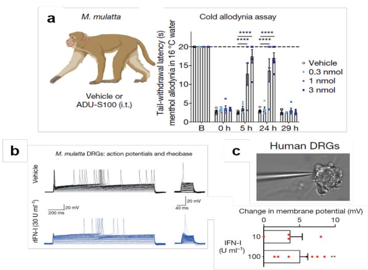 腰酸背痛吃点补品,腰酸背痛喝中药有效果吗
