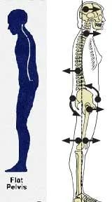 手法治疗中几种常见的姿势异常及评估