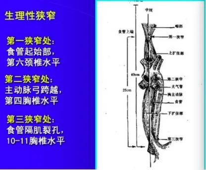 儿童误吞异物的正确方法,孩子不小心吞入异物卡住了怎么办