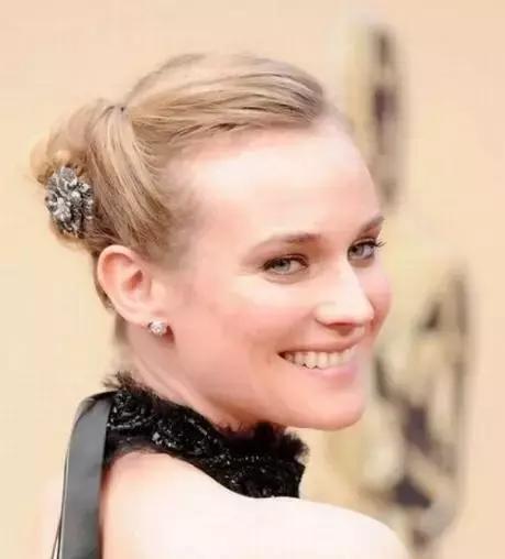 发际线后移的头发还能长出来么,头发发际线高还能长出来吗