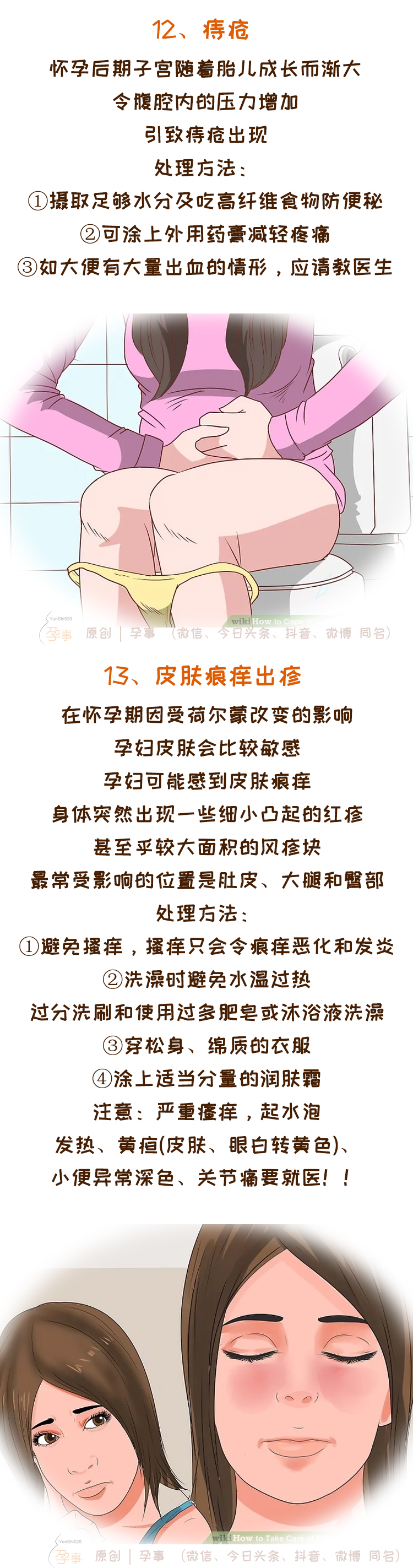 孕期应该知道的4件事,孕期应该知道的四件事