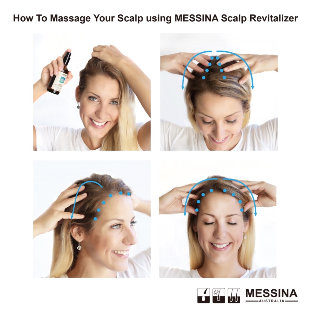 脱发脱成灭霸,我加入了妇愁者联盟!澳洲messina带你找回自信