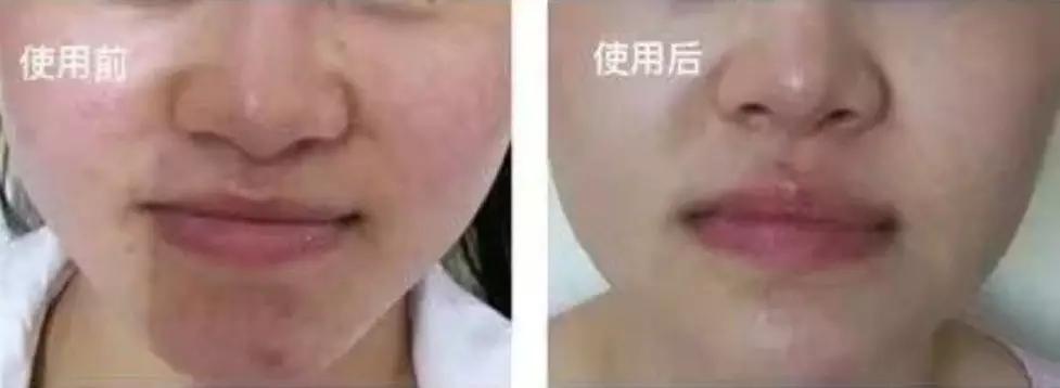 农科院研发的纯植物护肤品,农科院研究的护肤品