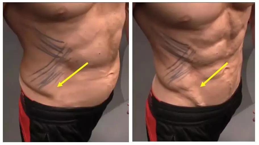 减掉腰间赘肉和肚子,减掉腰间赘肉的视频