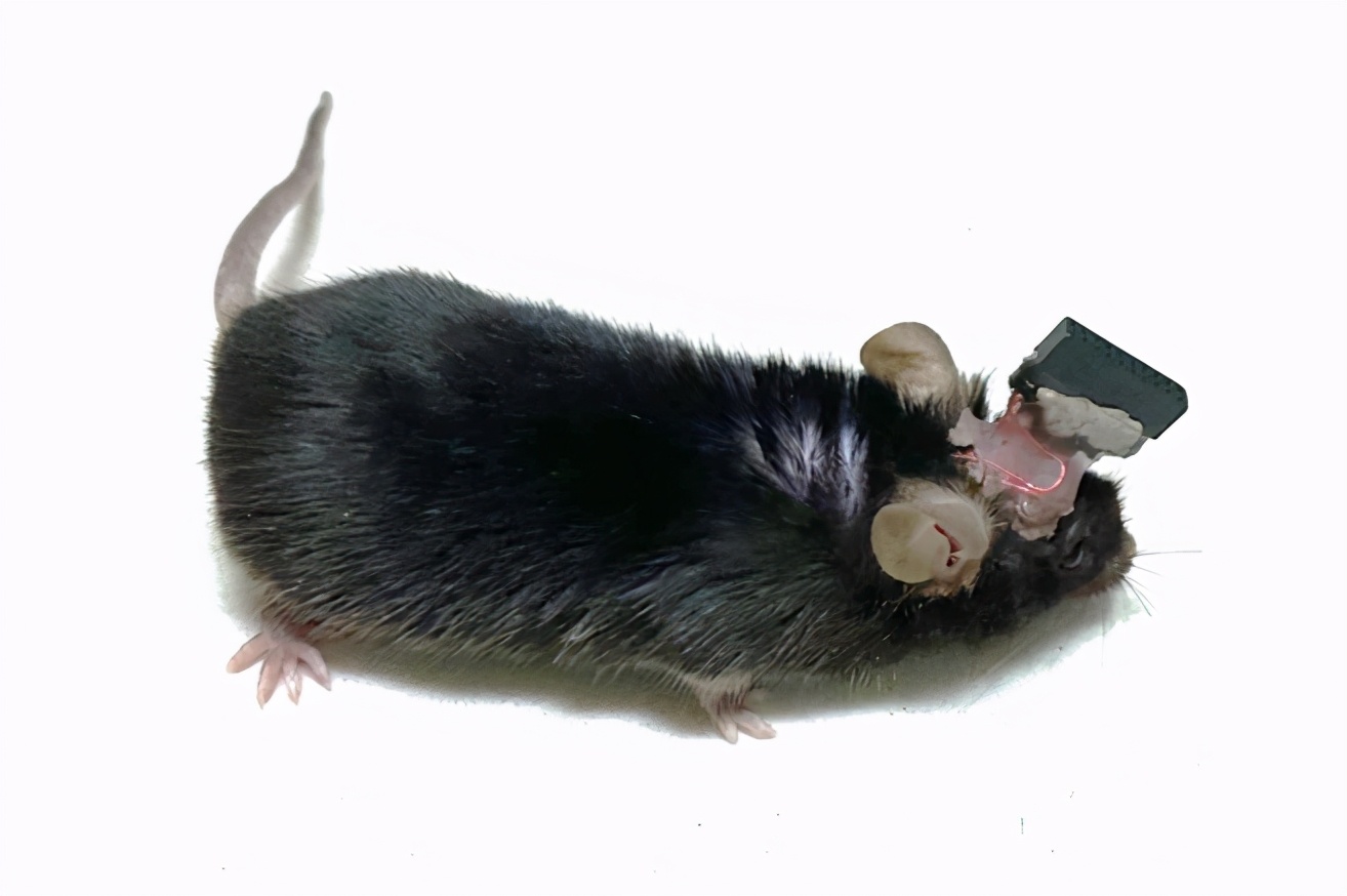 晶体植入手术的分享,可调微丝阵列电极