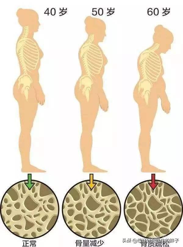 老年人天冷关节疼痛怎么缓解,老年人关节疼痛吃什么