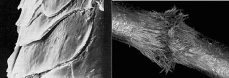 头发出油干燥脱发是什么原因,夏季头发出油严重