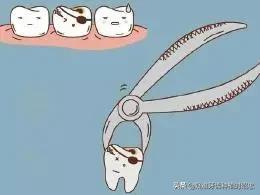 拔智齿的危险性和注意事项,拔智齿的危险和注意事项