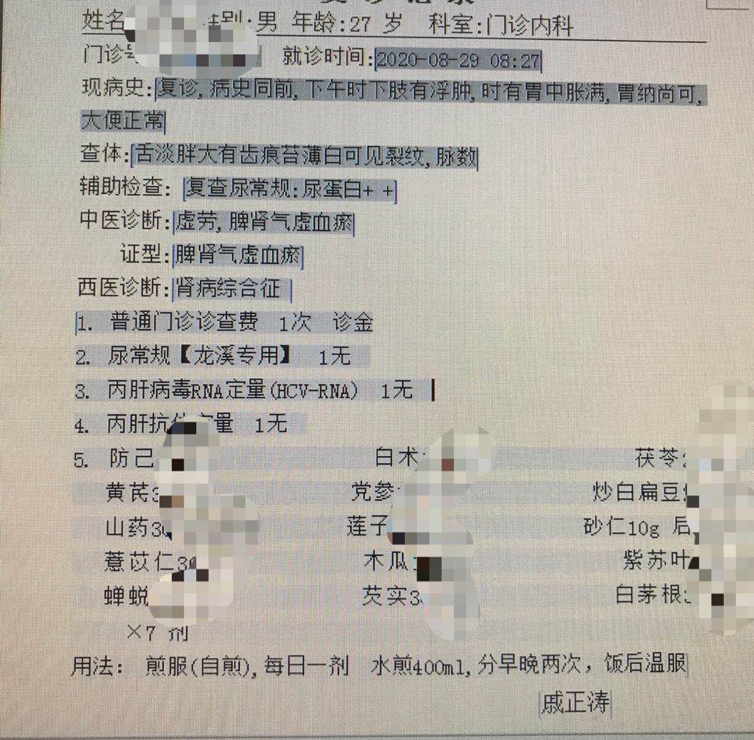 膜性肾病停药后尿蛋白反复,肾病综合征停药三年后复发了