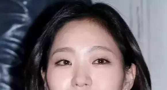 肿眼泡是什么原因啊,肿眼泡怎么贴双眼皮