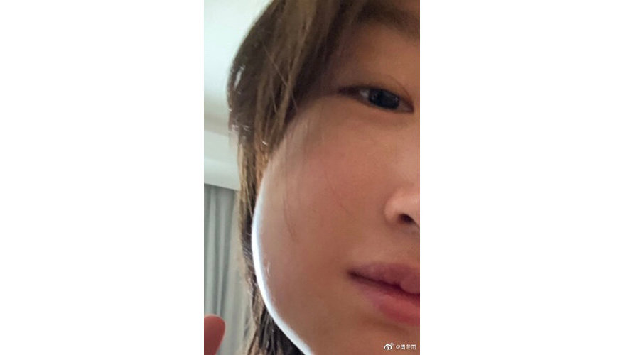 怀孕期间得了牙病怎么办,孕妇口腔治疗指南