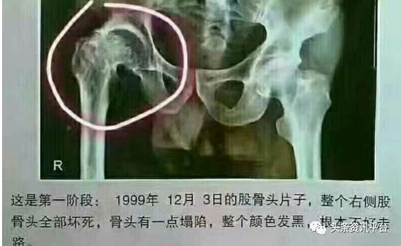 乐利来是合法直销吗,乐利来是正规直销吗