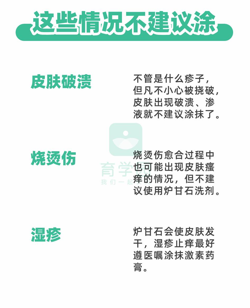 炉甘石什么皮肤病不能用,炉甘石没有副作用吗