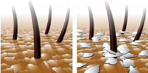 沙宣洗发水掉头发,沙宣洗发水洗了脱发