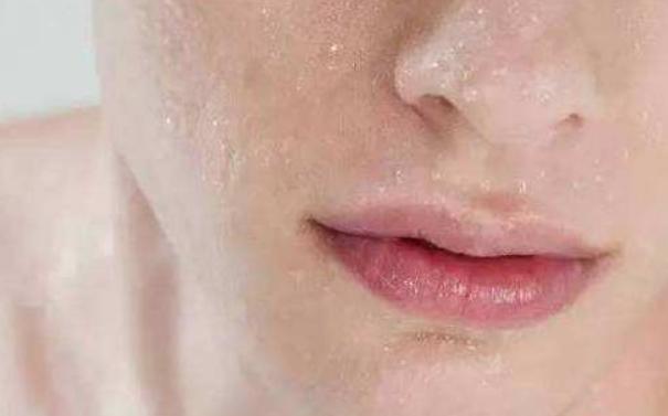 嘴唇干燥起皮用什么润唇膏最好,为什么涂了润唇膏嘴巴容易起皮