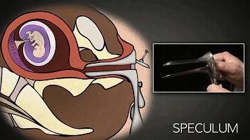 打胎有多可怕案例,20岁女生堕胎7次