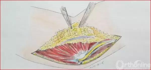 手绘科普视频,手绘类科普