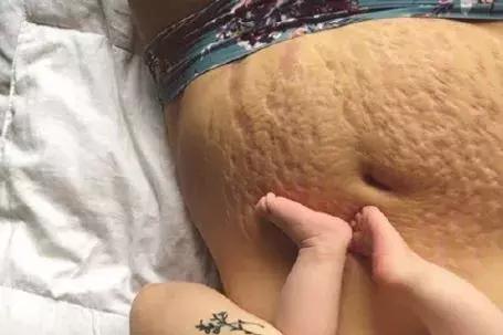 38岁天后自曝产后尿*禁失**：女人拿命生孩子，图什么？！