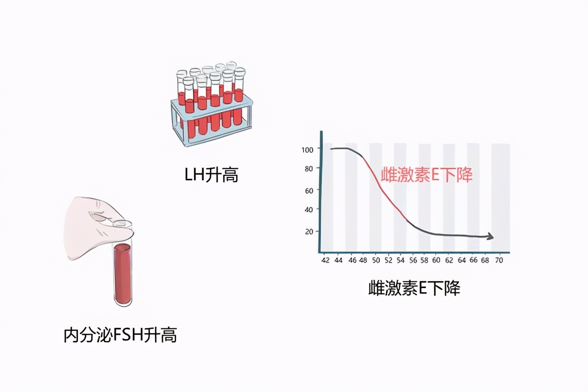 女性更年期的十大症状是真的吗,更年期怎么可以预防衰老