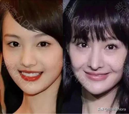 最自然的小翘鼻,鼻综合小翘鼻图片