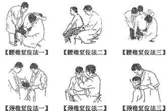 颈椎膨出应该怎么治疗才好呢？