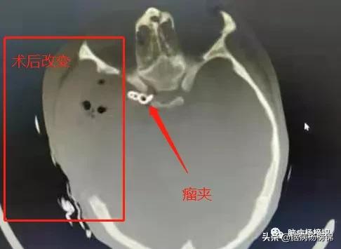 意外伤害很严重年纪轻轻难保命，谭院刀刀用真情豫南名医中中中